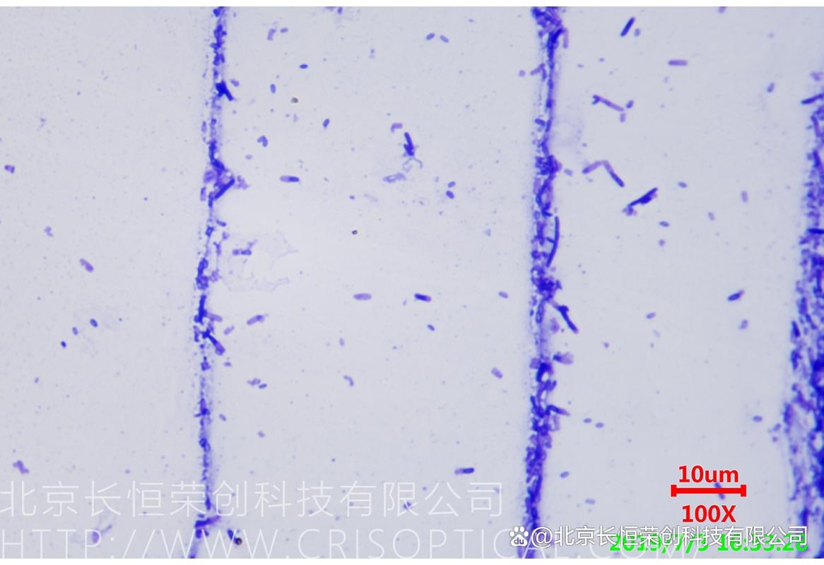 细菌芽孢 肥料厂 有机肥 革兰氏染色 长恒荣创显微镜应用案例